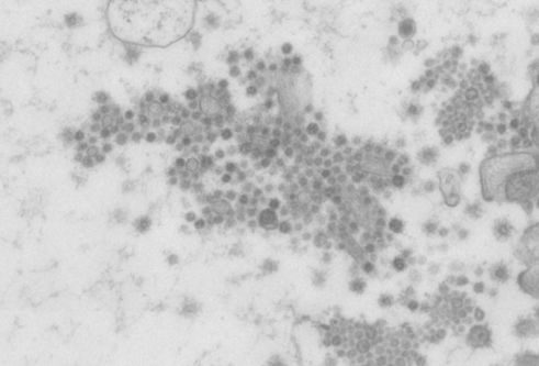 image shows part of the wider view of SARS-CoV-2 in human intestinal cells