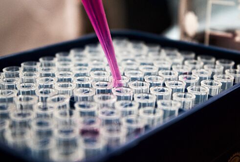 Pipette filed with pink liquid going into a tray of containers