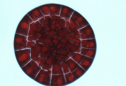 An image of a spot of blood drying (magnified) 