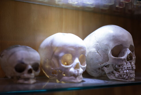 Three forensic dental skulls showing both upper and lower sets of teeth