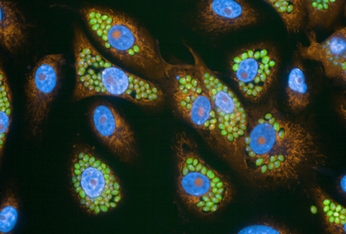 A close-up of tcruzi bacteria