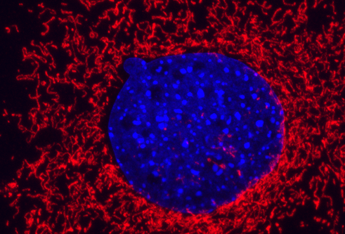 Microscope image. In the centre a blue circle surrounded by red wiggly lines on a black background