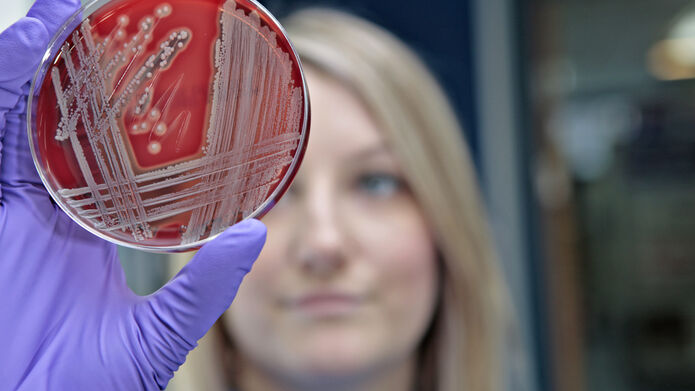 Microbiologist holding up petri dish with a pattern on it