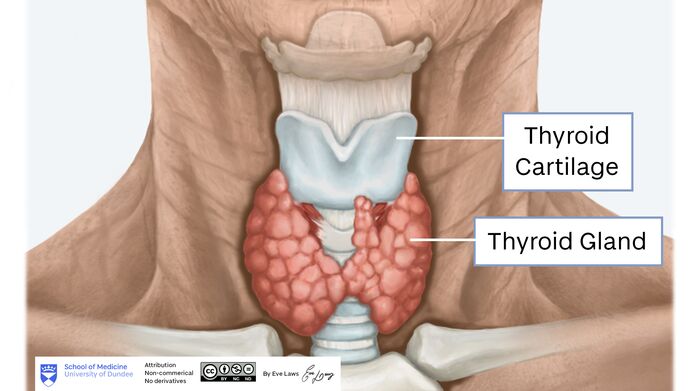 TILT illustration image