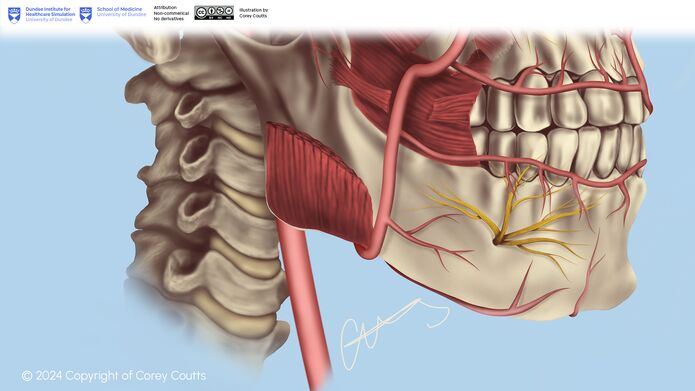 Illustration of some of the muscles, nerves and arteries of the lower face.