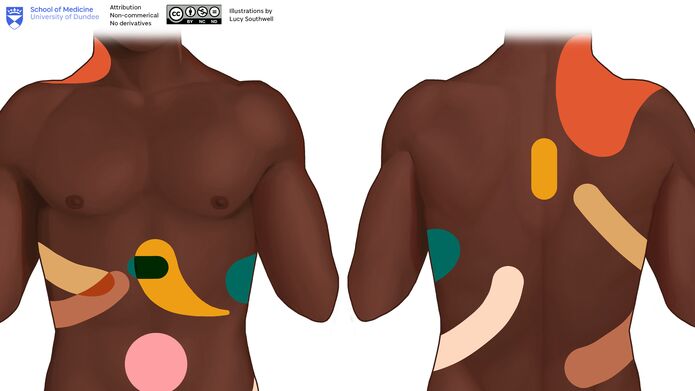 Close up of illustration showing referred pain landmarks.