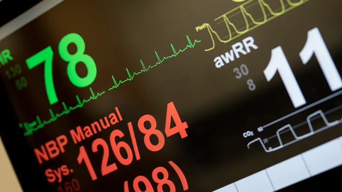 an image of a heart monitor displaying a heart rate of 78