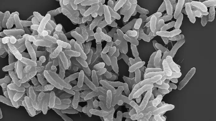 P. aeruginosa bacteria