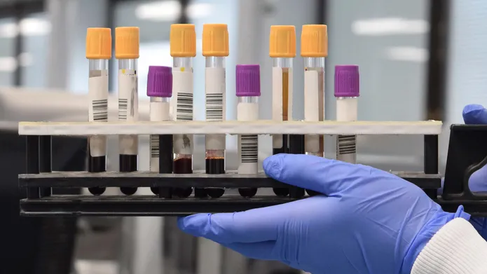 Researcher holding test tubes