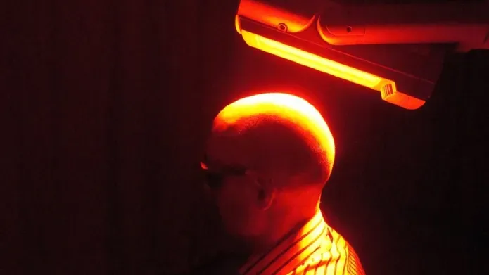 Person receiving Photodynamic therapy on their head