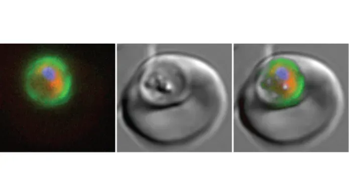 three microscope images of the same object. First a fuzzy circle to top left with green outer edge, blue dot in top middle and a crescent of red below the blue dot. Black background. Second a circle with a second circle to top left in grey scale. Third image, a merge of the first two.