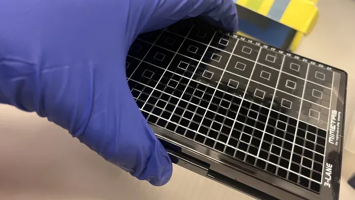 An example iPlacenta plate held in the hand of a Dundee researcher