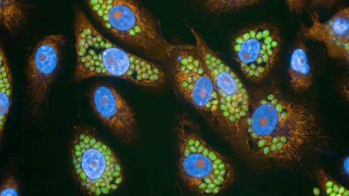 A close-up of tcruzi bacteria