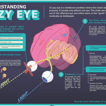 Poster entitled Understanding Lazy Eye