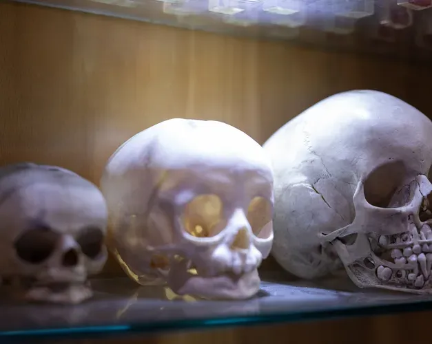 Three forensic dental skulls showing both upper and lower sets of teeth