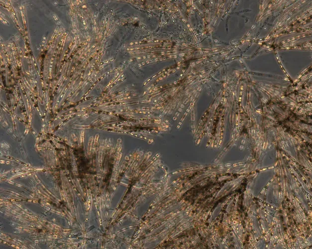 Microscope slide of algae