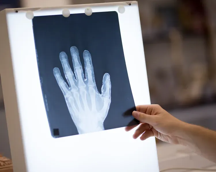an x-ray image of a hand