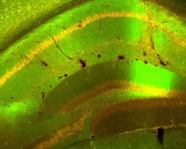 a microscopic image of a brain slice