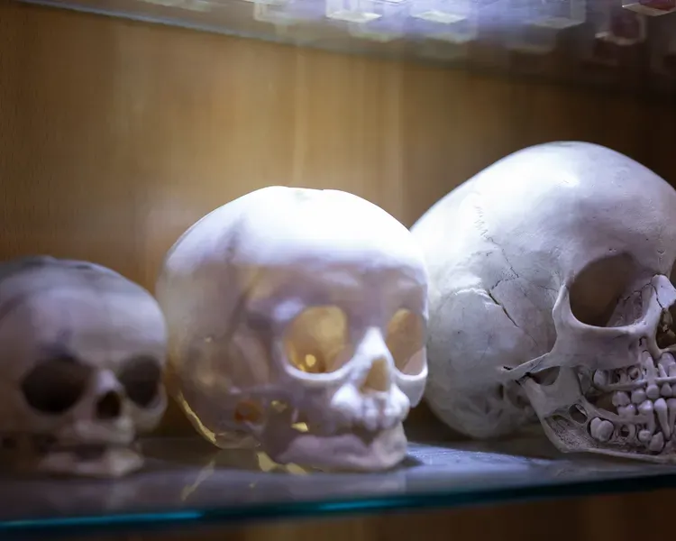 Three forensic dental skulls showing both upper and lower sets of teeth