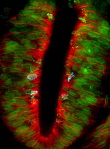 Cell division in the neural tube
