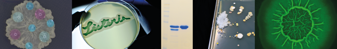 Five photographs combined into one image showing different microbes growing on agar plates and blue bands containing proteins on a gel.