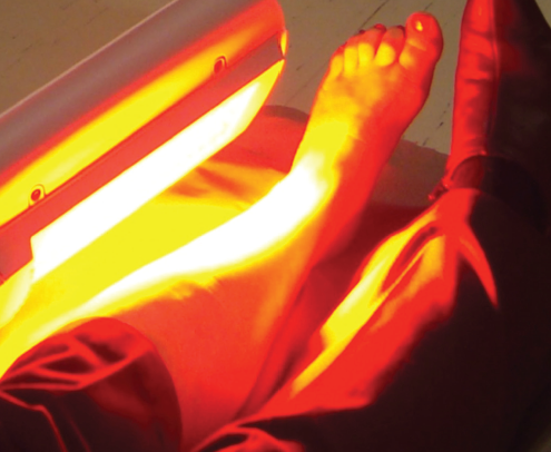 Foot receiving Photodynamic therapy