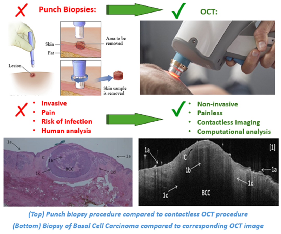 Image graphic showing how new device will operate, compared to previous device which punches through the skin.