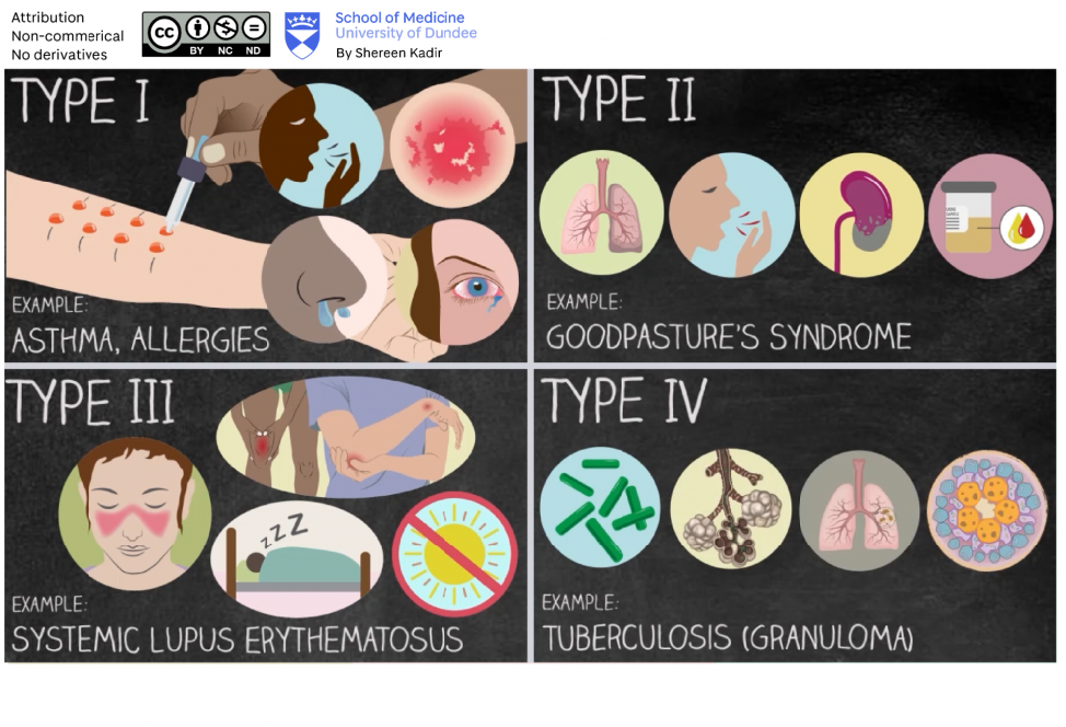 Medical illustration of allergen reactions