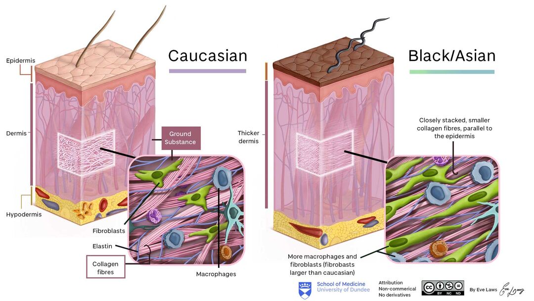 Dermatology – Collagen Fibres, Melanin Production and Neural Crest Cells