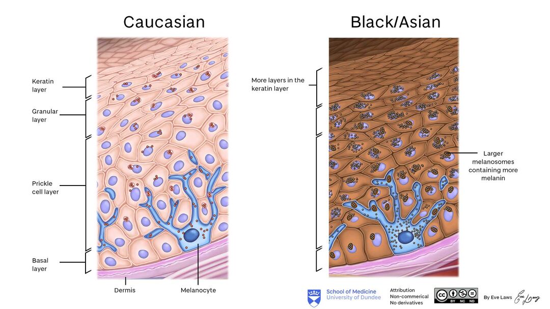 Dermatology – Collagen Fibres, Melanin Production and Neural Crest Cells