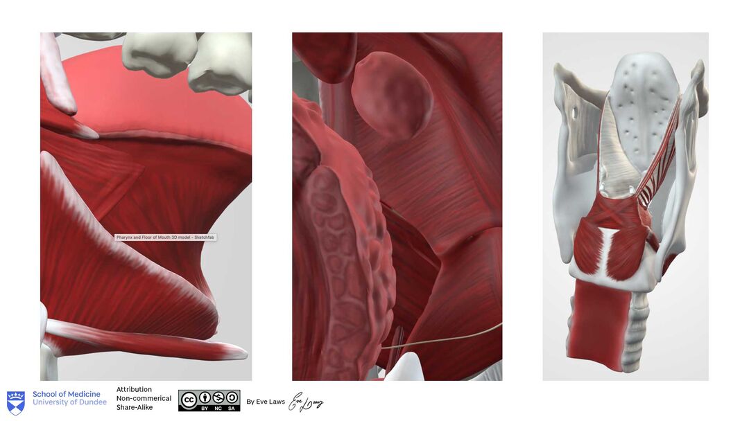 3D model of the parapharyngeal space, neck region and floor of mouth