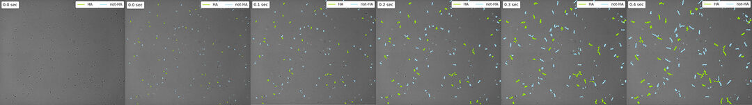 Several slides shows sperm motility assay (tracking sperm cells) 