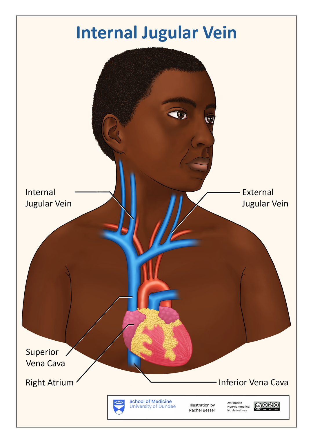 Illustration of the top half of a person with the internal jugular vein, external jugular vein, superior vena cava, right atrium of the heart and inferior vena cava highlighted. 