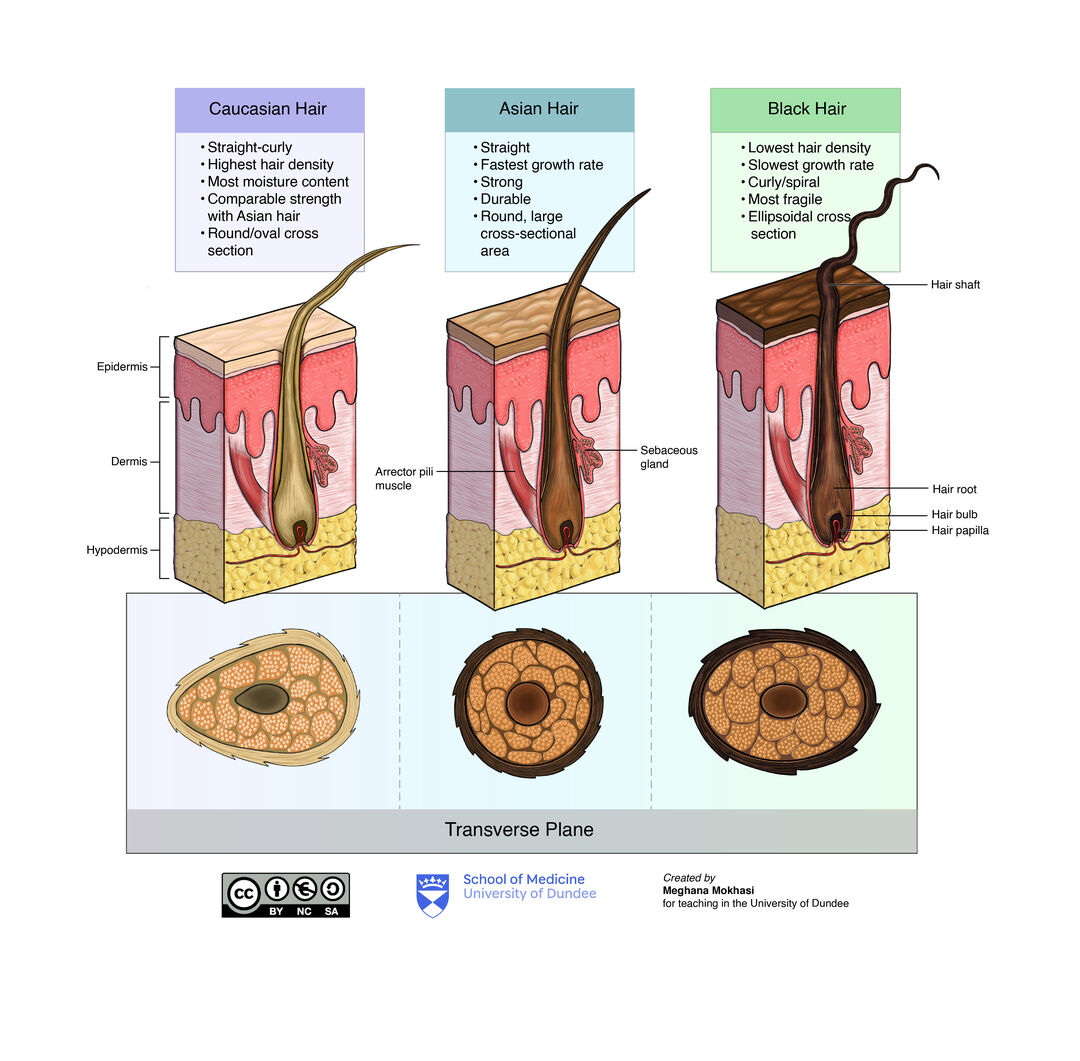 Illustration of hair follicle anatomy for Caucasian, Asian and black hair.
