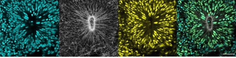 Human embryonic stem cell-derived neuroepithelial rosettes.